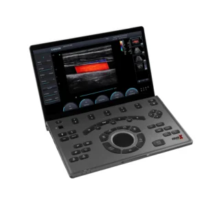 ULTRASONIDO SONOAIR CHISON