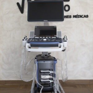 Ultrasonido Mindray vetus 5 CON 3 TRANSDUCTORES, LINEAL, MICROCONVEXO Y SECTORIAL.