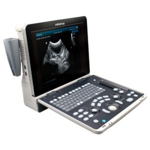 Ultrasonido Mindray Z50 CON TRANSDUCTOR ENDOCAVITARIO