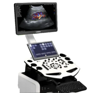 ULTRASONIDO VINNO S200 - Imagen 2