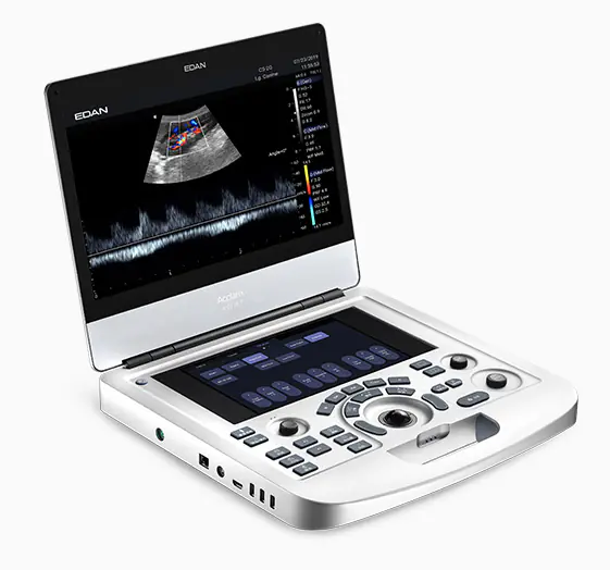 ULTRASONIDO VINNO EDAN AX3