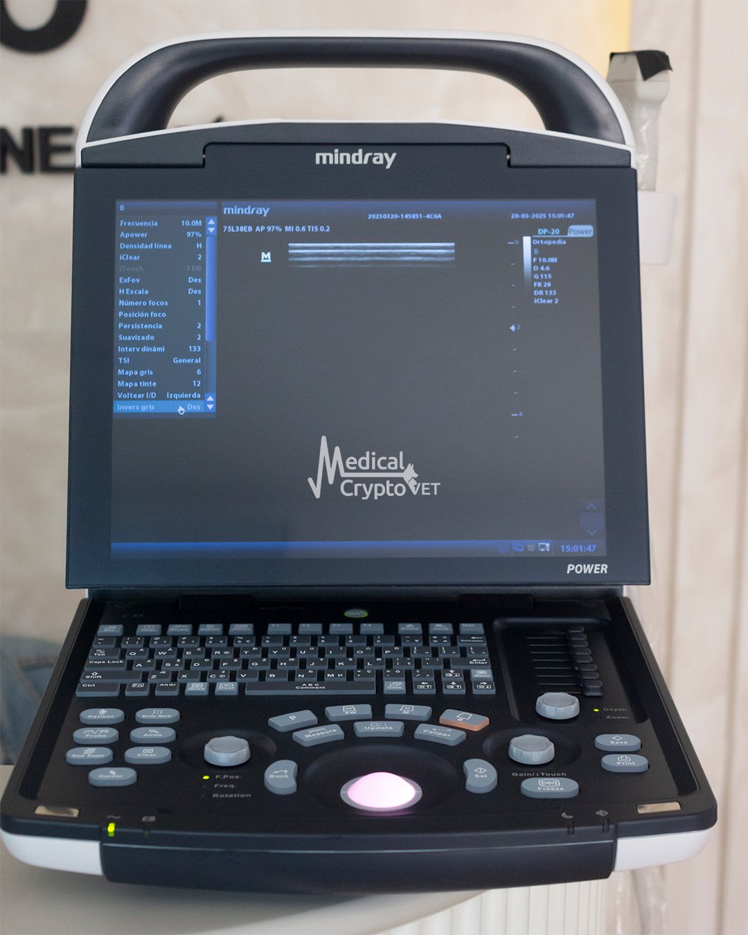 Ultrasonido Mindray DP10