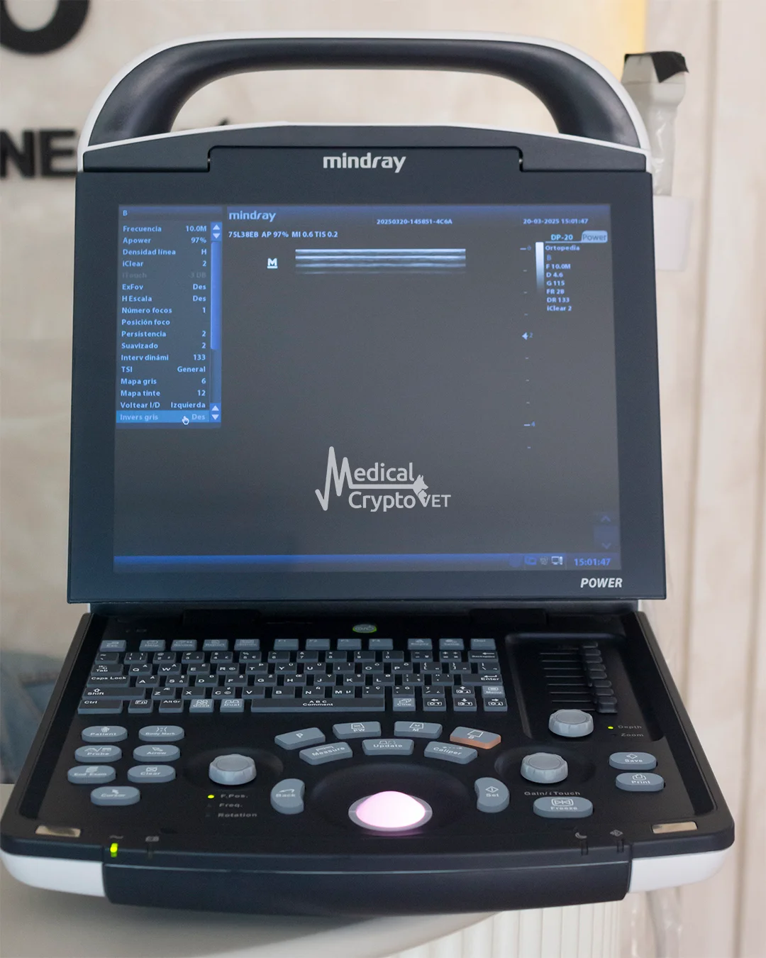 Ultrasonido Mindray Dp10 Transductor Rectal