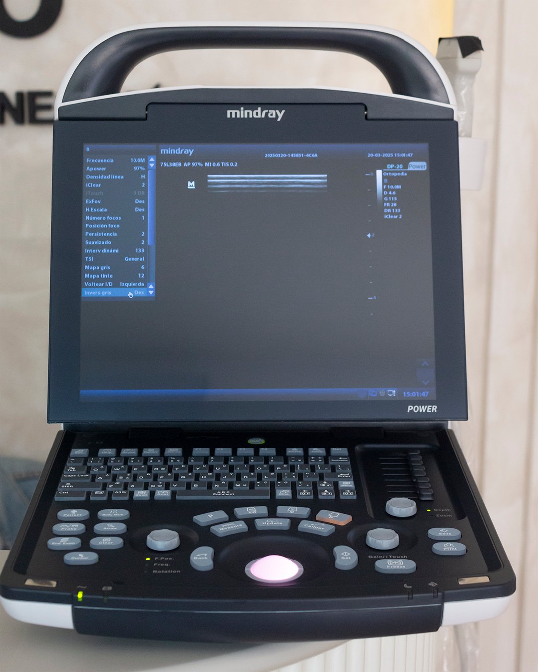 Ultrasonido Mindray DP 20