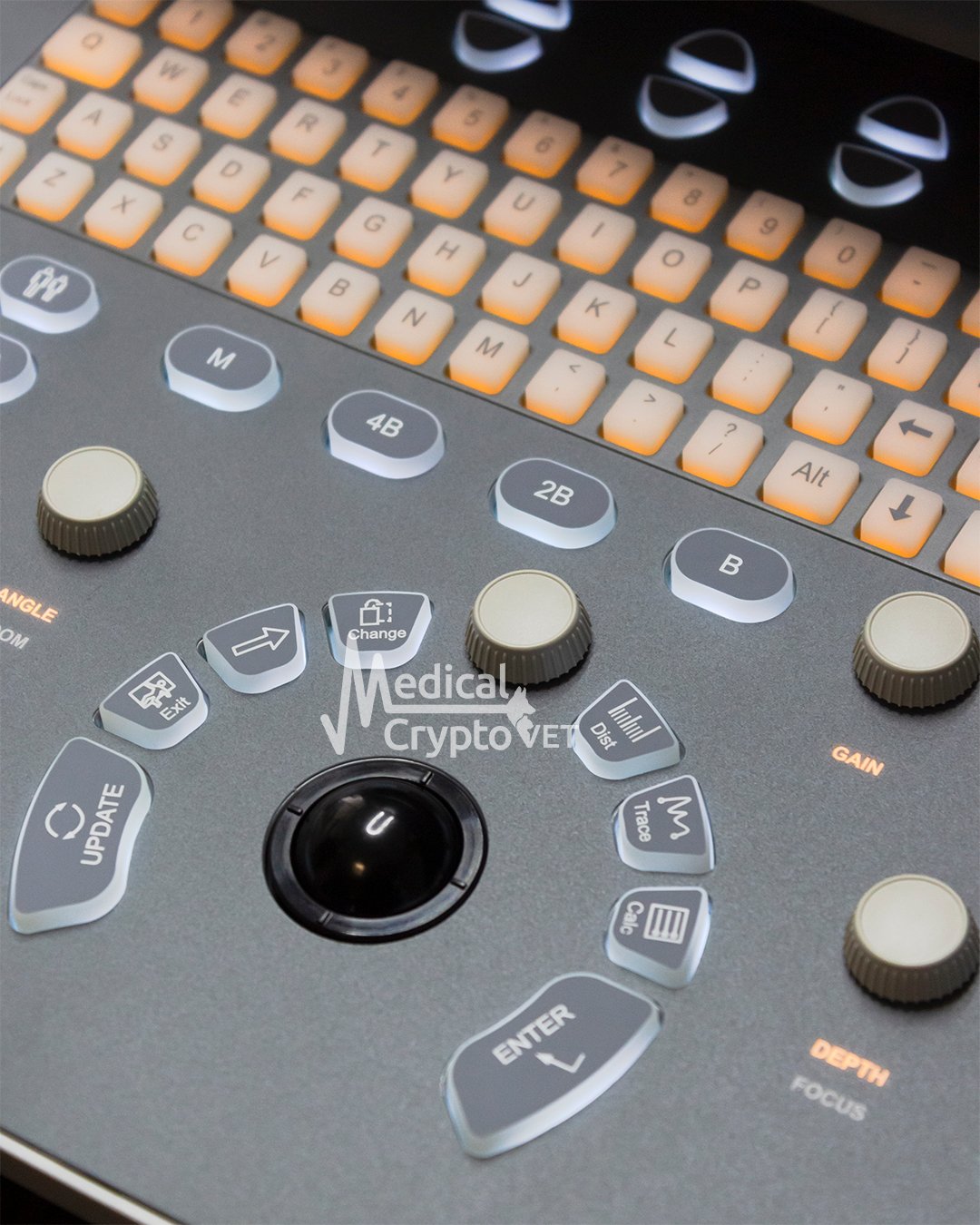 Ultrasonido Chison ECO 1