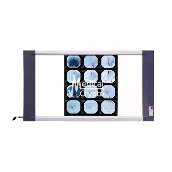 Negatoscopio Led Doble