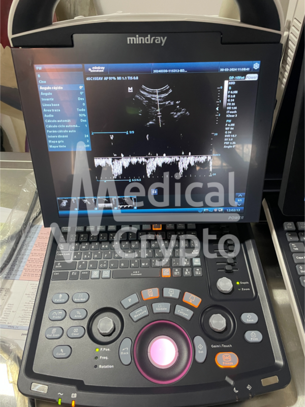MINDRAY DP1O + transductor microconvexo + mochila - para usoVeterinario - Imagen 3