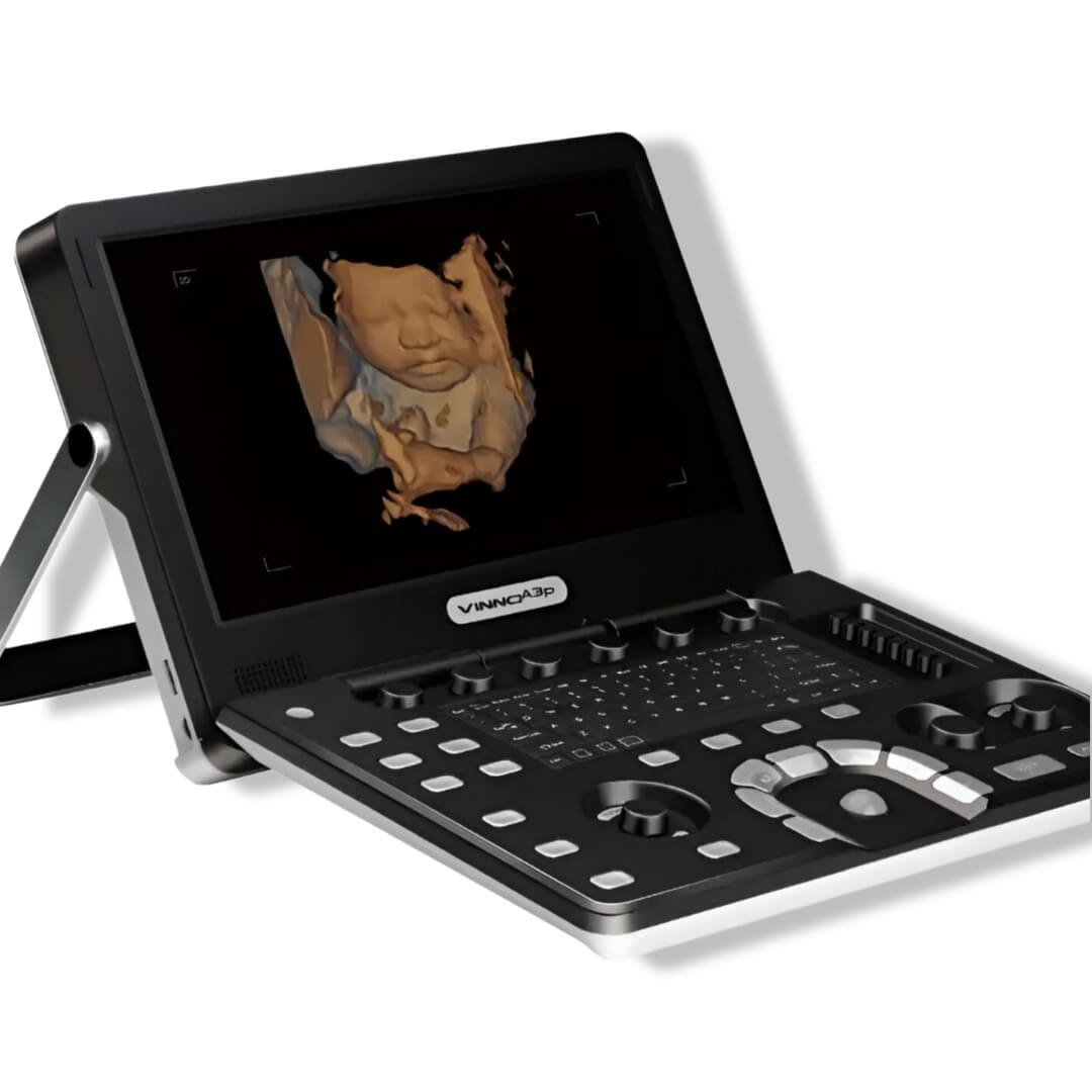 ULTRASONIDO VINNO A5