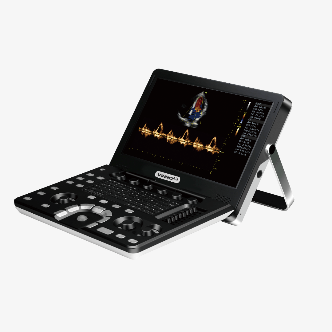 ULTRASONIDO VINNO A3