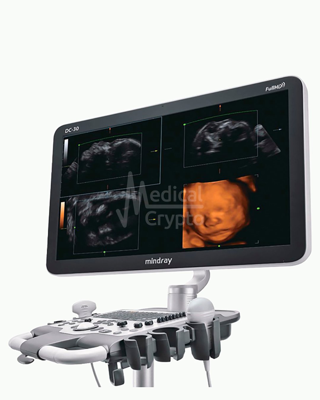 Ultrasonido Mindray DC 30 CON 2 TRANSDUCTORES, CONVEXO Y ENDOCAVITARIO