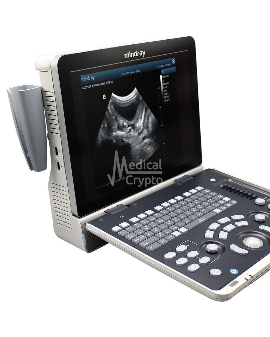 Ultrasonido Mindray Z50 CON TRANSDUCTOR CONVEXO