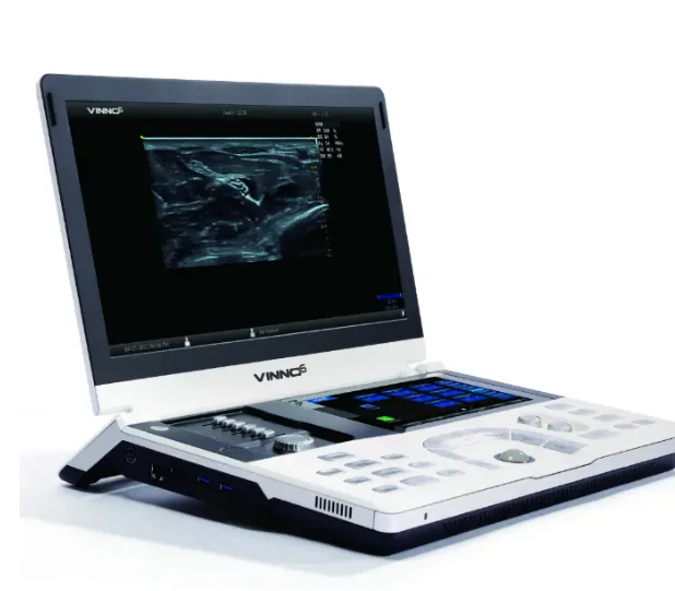 ULTRASONIDO VINNO 6