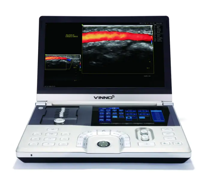 ULTRASONIDO VINNO 5