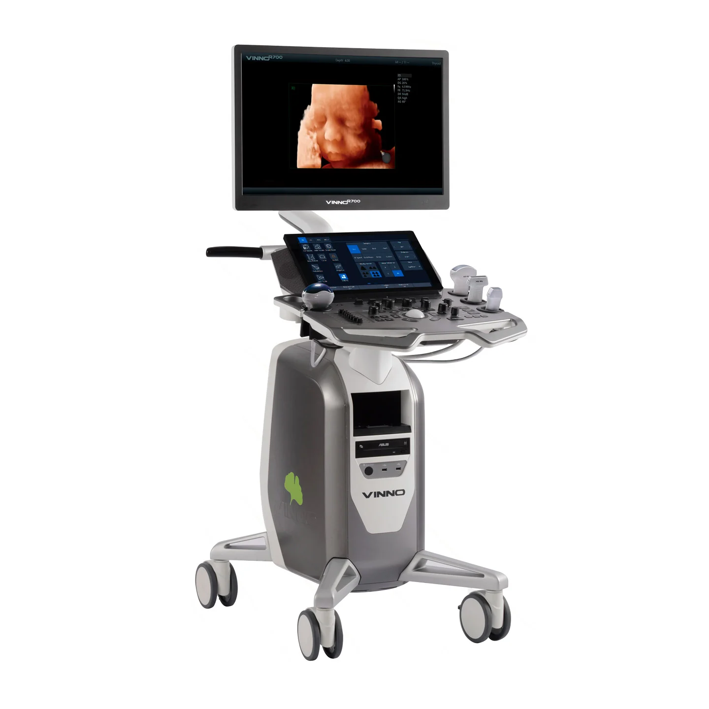 ULTRASONIDO VINNO R700