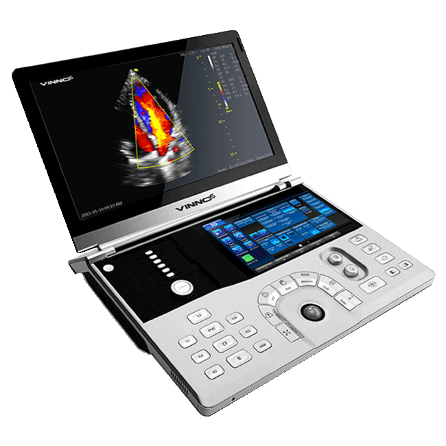 ULTRASONIDO VINNO 10